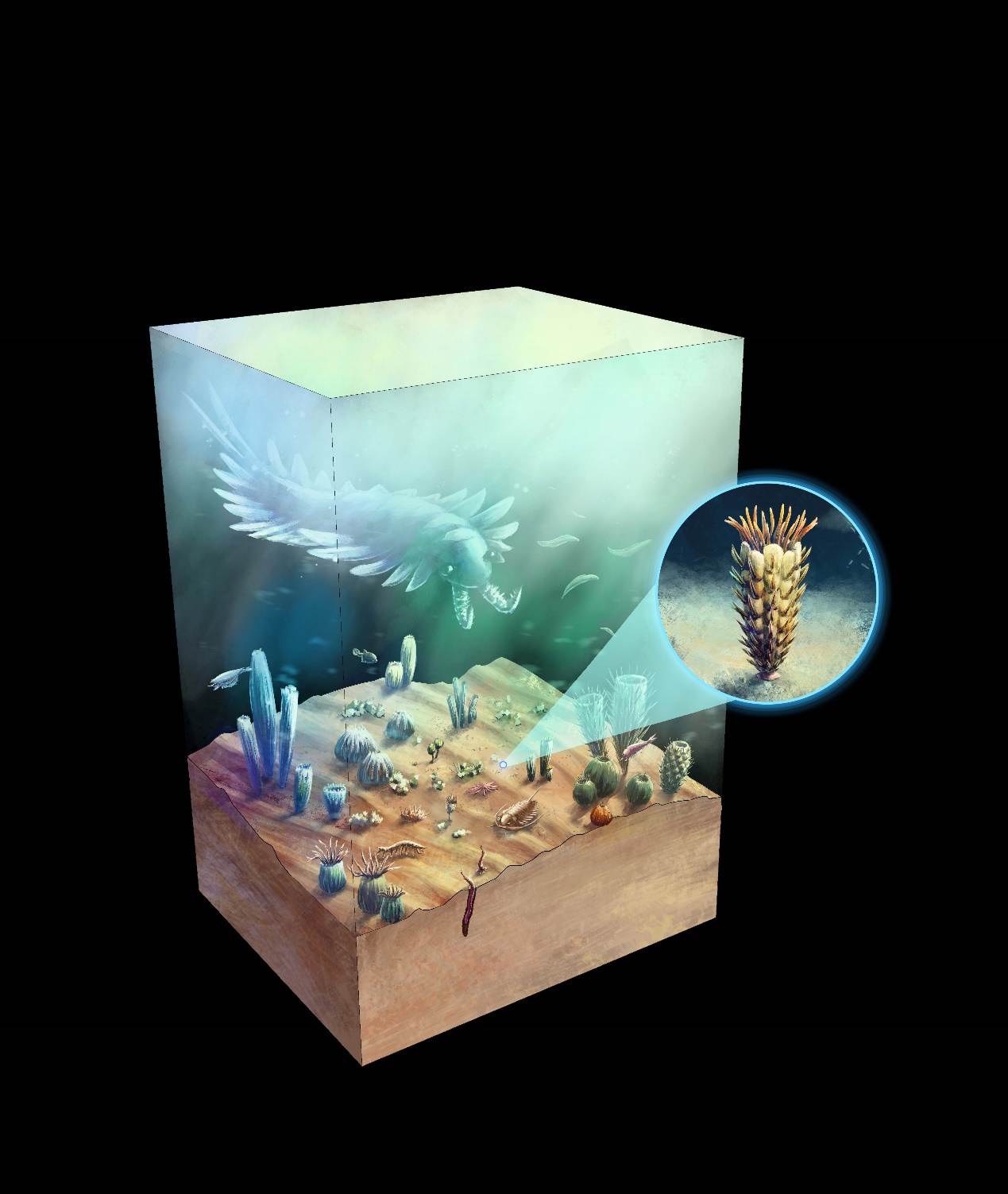 CT��ά�ؽ���ʾ������̦޺�滯ʯ���Ǻ�������ѻ�ʯ�����䶤��