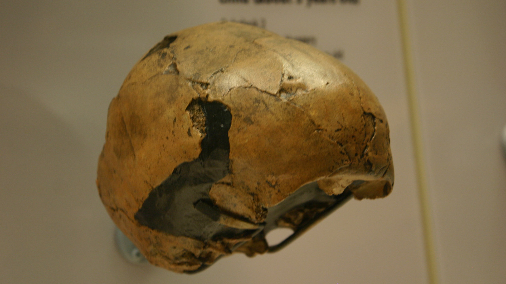 史前骨骼分析首次发现尼安德特人结核病病例