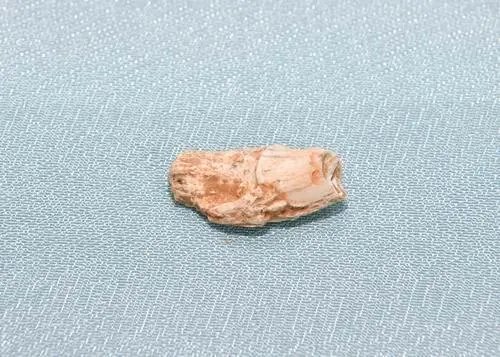 ������ɽ��������ַ���о��ɹ�����ŷ�ǵ������������翪�������ö�Ѩ��Դ����ַ