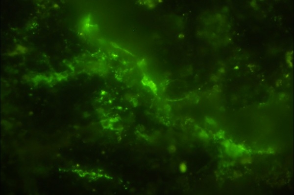 �Ϸ�20������ʯ�еĻ�΢����