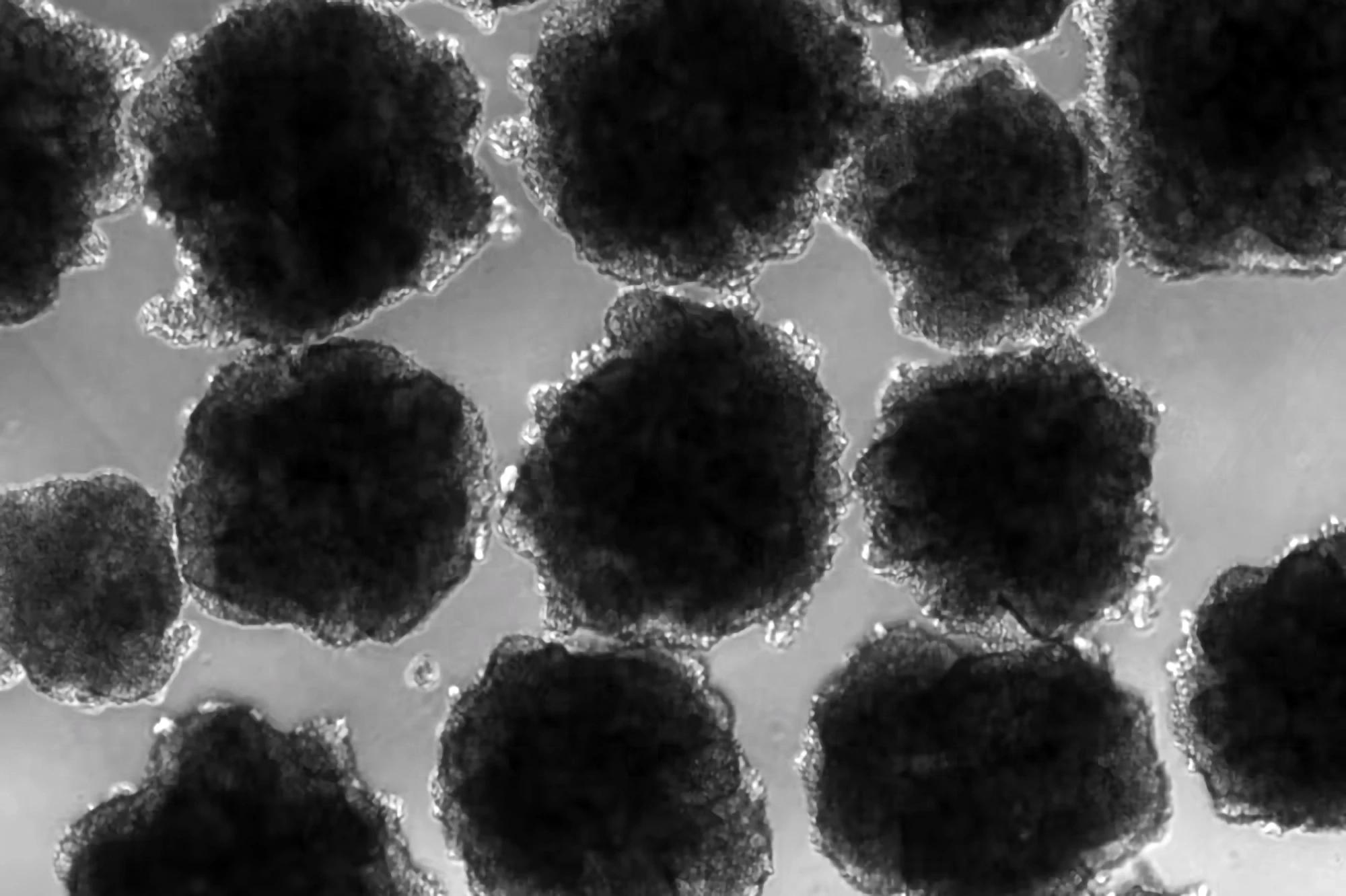 铅暴露影响了人类祖先的大脑进化与行为