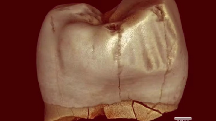 我们的祖先使用过“牙签”吗?